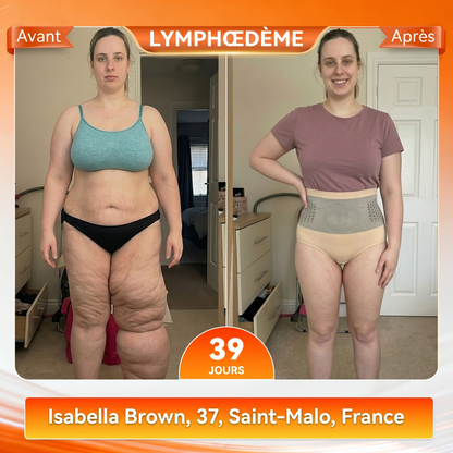 Boutique Officielle | ✅ 𝐏𝐀𝐔𝐑𝐀𝐉𝐔® 2026 Short Sculptant & Brûle-Graisses 4-en-1 aux Micro-Particules de Moringa & Berbérine🍀
