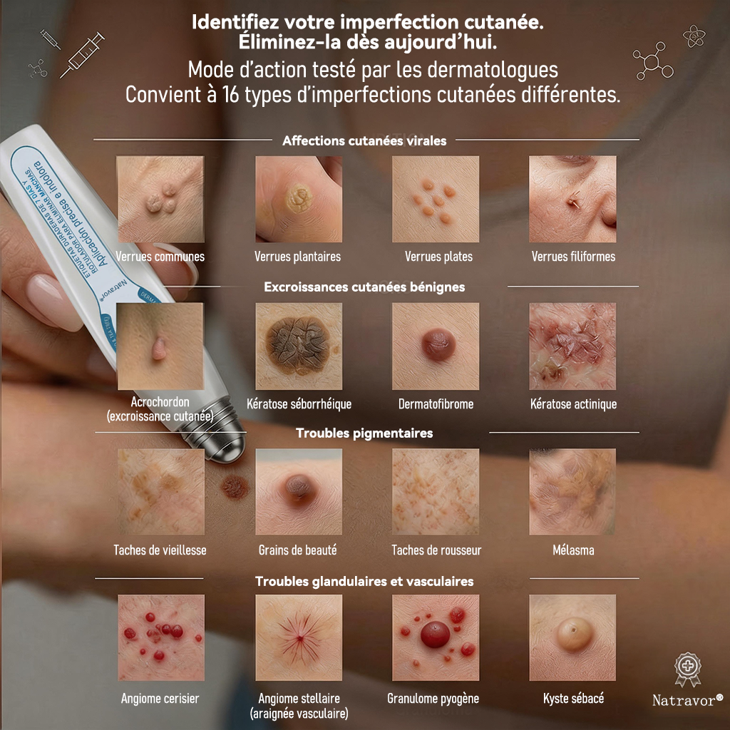 🎁 Plus que 5 disponibles ! Profitez de -50 % aujourd’hui ! Éliminez les acrochordons indésirables et retrouvez une peau plus lisse. Ne ratez pas cette offre exclusive : la prochaine chance sera l’année prochaine !